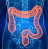 Doença Diverticular dos Cólons (Divertículos/Diverticulite)